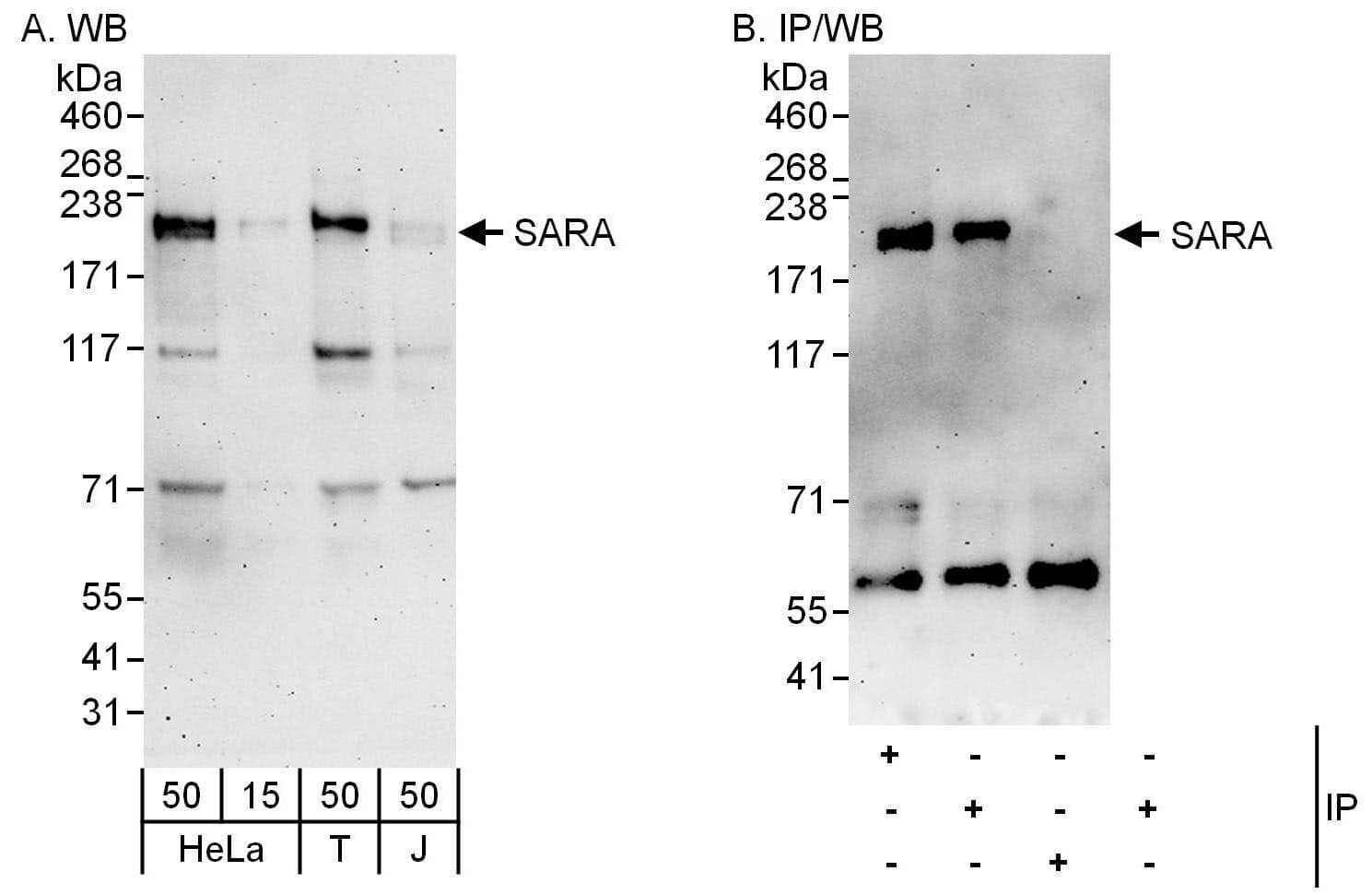 Western Blot:[NBP3-30527]-Detection of human SARA by western blot and immunoprecipitation. Samples: Whole cell lysate from HeLa , HEK293T and Jurkat cells. Antibodies: Affinity purified rabbit antibody used for WB at 0. 4 µg/ml and 1 µg/ml and used for IP at 6 µg/mg lysate. SARA was also immunoprecipitated by rabbit antibody , which recognizes a downstream epitope. Detection: Chemiluminescence with exposure times of 3 minutes.