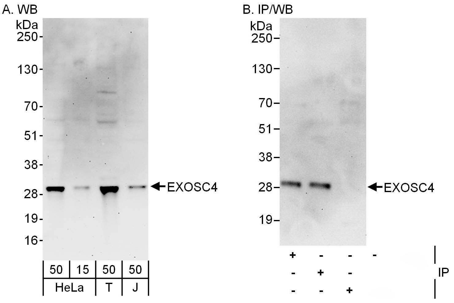 Western Blot:[NBP3-30528]-Detection of human EXOSC4 by western blot and immunoprecipitation. Samples: Whole cell lysate from HeLa , HEK293T and Jurkat cells. Antibodies: Affinity purified rabbit anti-EXOSC4 antibody used for WB at 0. 4 µg/ml and 1 µg/ml and used for IP at 6 µg/mg lysate. EXOSC4 was also immunoprecipitated by rabbit anti-EXOSC4 antibody , which recognizes a downstream epitope. Detection: Chemiluminescence with exposure times of 3 minutes and 30 seconds.