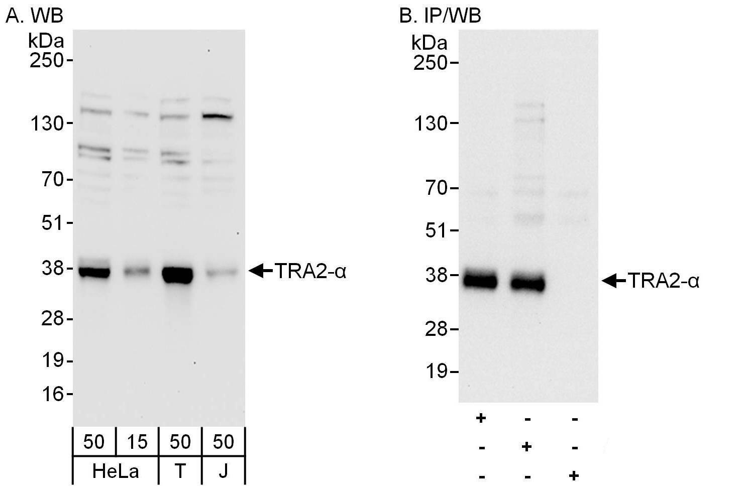 Western Blot:[NBP3-30529]-Detection of human TRA2- by western blot and immunoprecipitation. Samples: Whole cell lysate from HeLa , HEK293T and Jurkat cells. Antibodies: Affinity purified rabbit antibody used for WB at 0. 1 µg/ml and 0. 4 µg/ml and used for IP at 6 µg/mg lysate. TRA2- was also immunoprecipitated by rabbit antibody , which recognizes an upstream epitope. Detection: Chemiluminescence with exposure times of 30 seconds and 10 seconds.