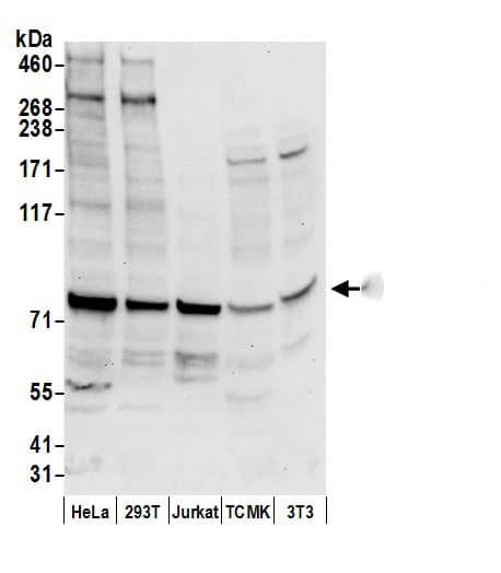 Western Blot:[NBP3-30532]-Detection of human and mouse APEH/AARE by western blot. Samples: Whole cell lysate from HeLa, HEK293T, Jurkat, mouse TCMK-1, and mouse NIH 3T3 cells prepared using NETN lysis buffer. Antibody: Affinity purified rabbit anti-APEH/AARE antibody used for WB at 0. 1 µg/ml. Detection: Chemiluminescence with an exposure time of 10 seconds.
