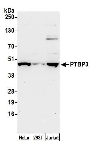 Western Blot ROD1 Antibody