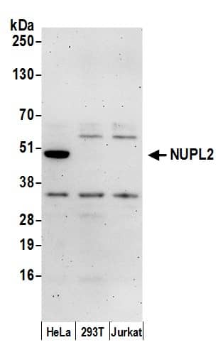 Western Blot NUPL2 Antibody