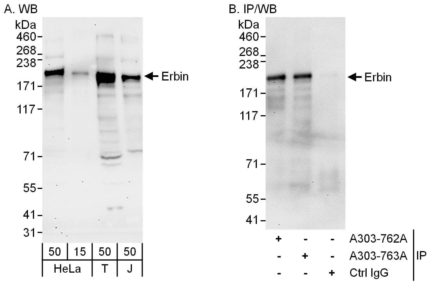 Western Blot:[NBP3-30540]-Detection of human Erbin by western blot and immunoprecipitation. Samples: Whole cell lysate from HeLa , HEK293T and Jurkat cells. Antibodies: Affinity purified rabbit anti-Erbin antibody used for WB at 0. 1 µg/ml and 1 µg/ml and used for IP at 6 µg/mg lysate. Erbin was also immunoprecipitated by rabbit anti-Erbin antibody , which recognizes an upstream epitope. Detection: Chemiluminescence with exposure times of 3 minutes and 30 seconds.