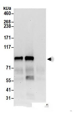 Immunoprecipitation MIOS Antibody - BSA Free