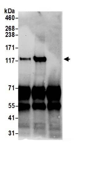 Immunoprecipitation:Nardilysin AntibodyNBP3-30543] -Detection of human NRD1 by western blot of immunoprecipitates. Samples: Whole cell lysate (0.5 or 1.0 mg per IP reaction; 20% of IP loaded) from 293T cells prepared using NETN lysis buffer. Antibodies: Affinity purified rabbit anti-NRD1 antibody NBP3-30543 (lot NBP3-30543-1) used for IP at 6 µg per reaction. NRD1 was also immunoprecipitated by rabbit anti-NRD1 antibody BL19671. For blotting immunoprecipitated NRD1, NBP3-30543 was used at 1 µg/ml. Detection: Chemiluminescence with an exposure time of 30 seconds.