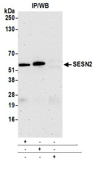 Immunoprecipitation:[NBP3-30544]-Detection of human SESN2 by western blot of immunoprecipitates. Samples: Whole cell lysate from HEK293T cells prepared using NETN lysis buffer. Antibodies: Affinity purified rabbit anti-SESN2 antibody used for IP at 1 µg per reaction. SESN2 was also immunoprecipitated by rabbit anti-SESN2 antibody. For blotting immunoprecipitated SESN2, was used at 0. 04 mg/ml. Detection: Chemiluminescence with an exposure time of 3 minutes.