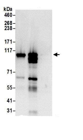 Immunoprecipitation:ARS2 AntibodyNBP3-30547] -Detection of human ARS2 by western blot of immunoprecipitates. Samples: Whole cell lysate (0.5 or 1.0 mg per IP reaction; 20% of IP loaded) from Jurkat cells prepared using NETN lysis buffer. Antibodies: Affinity purified rabbit anti-ARS2 antibody NBP3-30547 (lot NBP3-30547-1) used for IP at 6 µg per reaction. ARS2 was also immunoprecipitated by rabbit anti-ARS2.. For blotting immunoprecipitated ARS2, NBP3-30547 was used at 1 µg/ml. Detection: Chemiluminescence with an exposure time of 3 seconds.