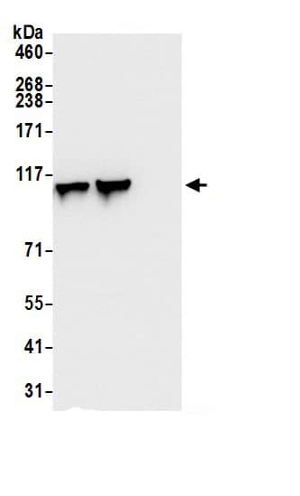 Immunoprecipitation:MVP AntibodyNBP3-30548] -Detection of human MVP by western blot of immunoprecipitates. Samples: Whole cell lysate (0.5 or 1.0 mg per IP reaction; 20% of IP loaded) from HeLa cells prepared using NETN lysis buffer. Antibodies: Affinity purified rabbit anti-MVP antibody NBP3-30548 (lot NBP3-30548-1) used for IP at 6 µg per reaction. MVP was also immunoprecipitated by rabbit anti-MVP.. For blotting immunoprecipitated MVP, NBP3-30548 was used at 0.4 µg/ml. Detection: Chemiluminescence with an exposure time of 1 second.