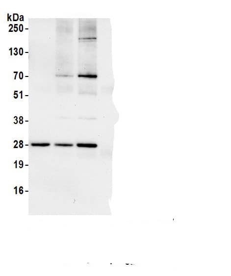 Immunoprecipitation:RPL10A AntibodyNBP3-30550] -Detection of human RPL10A by western blot of immunoprecipitates. Samples: Whole cell lysate (1.0 mg per IP reaction; 20% of IP loaded) from HEK293T cells prepared using NETN lysis buffer. Antibodies: Affinity purified rabbit anti-RPL10A antibody (NBP3-30550 lot 2) used for IP at 6 µg per reaction. RPL10A was also immunoprecipitated by a previous lot of this antibody (NBP3-30550 lot 1) and a second.inst a different epitope of RPL10A . For blotting immunoprecipitated RPL10A, NBP3-30550 was used at 0.4 µg/ml. Detection: Chemiluminescence with an exposure time of 30 seconds.