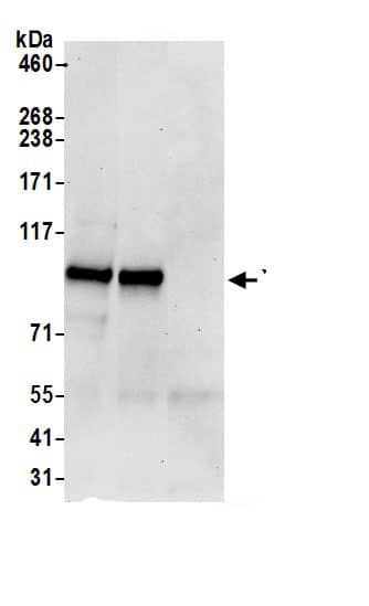 Immunoprecipitation:YTHDC1 AntibodyNBP3-30551] -Detection of human YTHDC1 by western blot of immunoprecipitates. Samples: Whole cell lysate (0.5 or 1.0 mg per IP reaction; 20% of IP loaded) from 293T cells prepared using NETN lysis buffer. Antibodies: Affinity purified rabbit anti-YTHDC1 antibody NBP3-30551 (lot NBP3-30551-1) used for IP at 6 µg per reaction. YTHDC1 was also immunoprecipitated by rabbit anti-YTHDC1 antibody BL20012. For blotting immunoprecipitated YTHDC1, NBP3-30551 was used at 0.4 µg/ml. Detection: Chemiluminescence with an exposure time of 30 seconds.