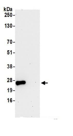 Immunoprecipitation:gamma-Glutamylcyclotransferase/CRF21/GGCT AntibodyNBP3-30552] -Detection of human GGCT by western blot of immunoprecipitates. Samples: Whole cell lysate (0.5 or 1.0 mg per IP reaction; 20% of IP loaded) from 293T cells prepared using NETN lysis buffer. Antibodies: Affinity purified rabbit anti-GGCT antibody NBP3-30552 (lot NBP3-30552-1) used for IP at 6 µg per reaction. For blotting immunoprecipitated GGCT, NBP3-30552 was used at 1 µg/ml. Detection: Chemiluminescence with an exposure time of 30 seconds.