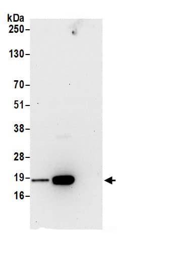 Immunoprecipitation:REEP5 AntibodyNBP3-30554] -Detection of human REEP5 by western blot of immunoprecipitates. Samples: Whole cell lysate (0.5 or 1.0 mg per IP reaction; 20% of IP loaded) from 293T cells prepared using NETN lysis buffer. Antibodies: Affinity purified rabbit anti-REEP5 antibody NBP3-30554 (lot NBP3-30554-1) used for IP at 6 µg per reaction. REEP5 was also immunoprecipitated by rabbit anti-REEP5 antibody BL21855. For blotting immunoprecipitated REEP5, NBP3-30554 was used at 0.4 µg/ml. Detection: Chemiluminescence with an exposure time of 30 seconds.