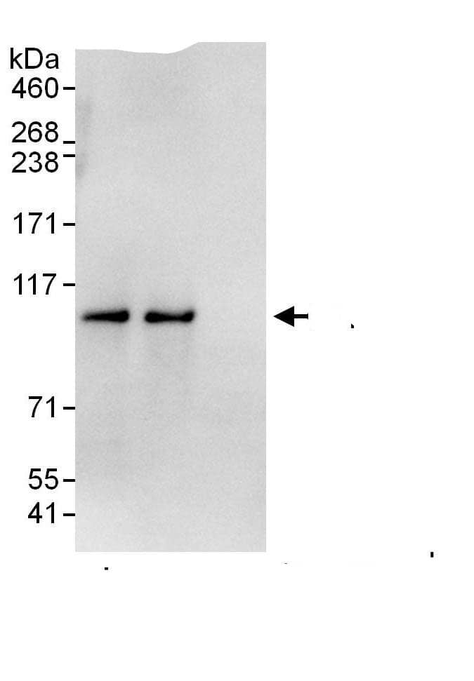 Immunoprecipitation:Proteasome 19S 10B AntibodyNBP3-30555] -Detection of human PSMD2 by western blot of immunoprecipitates. Samples: Whole cell lysate (1 mg for IP; 20% of IP loaded) from HEK293T cells. Antibodies: Affinity purified rabbit anti-PSMD2 antibody NBP3-30555 (lot NBP3-30555-1) used for IP at 6 µg/mg lysate. PSMD2 was also immunoprecipitated by rabbit anti-PSMD2.. For blotting immunoprecipitated PSMD2, NBP3-30555 was used at 1 µg/ml. Detection: Chemiluminescence with an exposure time of 3 seconds.