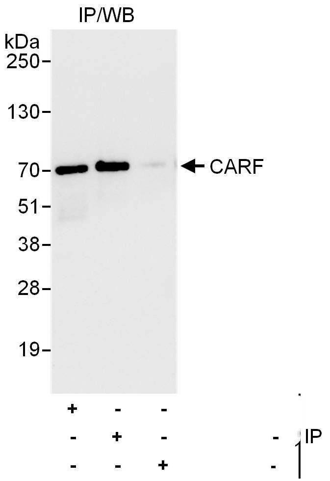 Immunoprecipitation:[NBP3-30557]-Detection of human CARF by western blot of immunoprecipitates. Samples: Whole cell lysate from HEK293T cells. Antibodies: Affinity purified rabbit anti-CARF antibody used for IP at 6 µg/mg lysate. CARF was also immunoprecipitated by rabbit anti-CARF antibody. For blotting immunoprecipitated CARF, was used at 1 µg/ml. Detection: Chemiluminescence with an exposure time of 10 seconds.