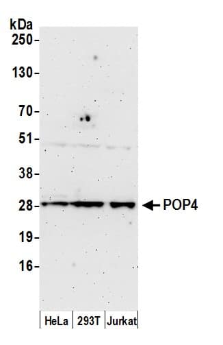 Western Blot:[NBP3-30562]-Detection of human POP4 by western blot. Samples: Whole cell lysate from HeLa, HEK293T, and Jurkat cells prepared using NETN lysis buffer. Antibody: Affinity purified rabbit anti-POP4 antibody used for WB at 0. 1 mg/ml. Detection: Chemiluminescence with an exposure time of 3 minutes.