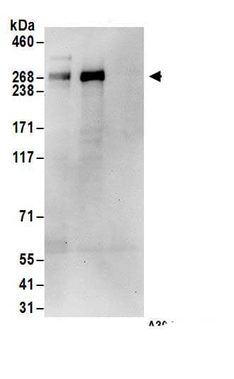 Immunoprecipitation:ASCC3 AntibodyNBP3-30564] -Detection of human ASCC3 by western blot of immunoprecipitates. Samples: Whole cell lysate (1 mg for IP; 20% of IP loaded) from HEK293T cells. Antibodies: Affinity purified rabbit anti-ASCC3 antibody NBP3-30564 (lot NBP3-30564-1) used for IP at 6 µg/mg lysate. ASCC3 was also immunoprecipitated by rabbit anti-ASCC3.. For blotting immunoprecipitated ASCC3, NBP3-30564 was used at 1 µg/ml. Detection: Chemiluminescence with an exposure time of 30 seconds.