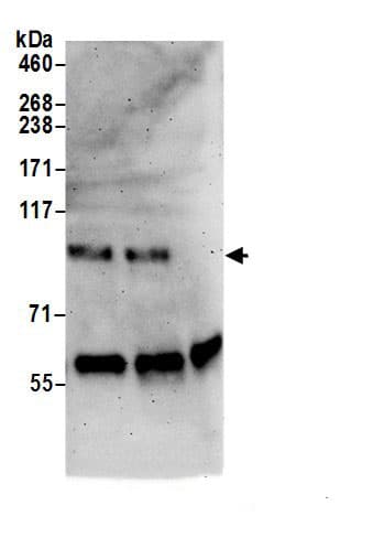 Immunoprecipitation:MOCOS AntibodyNBP3-30565] -Detection of human MOCOS by western blot of immunoprecipitates. Samples: Whole cell lysate (0.5 or 1.0 mg per IP reaction; 20% of IP loaded) from HeLa cells prepared using NETN lysis buffer. Antibodies: Affinity purified rabbit anti-MOCOS antibody NBP3-30565 (lot NBP3-30565-1) used for IP at 6 µg per reaction. MOCOS was also immunoprecipitated by rabbit anti-MOCOS antibody BL19427. For blotting immunoprecipitated MOCOS, NBP3-30565 was used at 1 µg/ml. Detection: Chemiluminescence with an exposure time of 3 minutes.