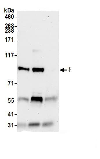 Immunoprecipitation:SARDH AntibodyNBP3-30570] -Detection of human SARDH by western blot of immunoprecipitates. Samples: Whole cell lysate (1.0 mg per IP reaction; 20% of IP loaded) from Hep-G2 cells prepared using NETN lysis buffer. Antibodies: Affinity purified rabbit anti-SARDH antibody (NBP3-30570 lot 1) used for IP at 2 µg per reaction. SARDH was also immunoprecipitated by rabbit anti-SARDH.. For blotting immunoprecipitated SARDH, NBP3-30570 was used at 0.1 mg/ml. Detection: Chemiluminescence with an exposure time of 30 seconds.