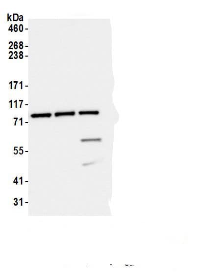 Immunoprecipitation:COPB2 AntibodyNBP3-30571] -Detection of human COPB2 by western blot of immunoprecipitates. Samples: Whole cell lysate (1.0 mg per IP reaction; 20% of IP loaded) from HEK293T cells prepared using NETN lysis buffer. Antibodies: Affinity purified rabbit anti-COPB2 antibody (NBP3-30571 lot 2) used for IP at 6 µg per reaction. COPB2 was also immunoprecipitated by a previous lot of this antibody (NBP3-30571 lot 1) and a second.inst a different epitope of COPB2 (A304-522A). For blotting immunoprecipitated COPB2, NBP3-30571 was used at 0.04 µg/ml. Detection: Chemiluminescence with an exposure time of 1 second.