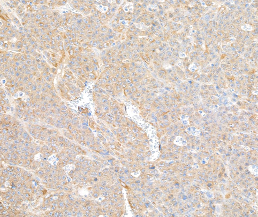 Immunohistochemistry;COPB2 Antibody[NBP3-30571]Detection of mouse COPB2 by immunohistochemistry. Samples: FFPE section of mouse plasmacytoma. Antibody: Affinity purified rabbit anti-COPB2  used at a dilution of 1:1,000 . Detection: DAB