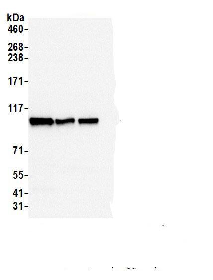 Immunoprecipitation:Rpn2 AntibodyNBP3-30572] -Detection of human PSMD1 by western blot of immunoprecipitates. Samples: Whole cell lysate (200 µg per IP reaction; 5% of IP loaded) from HEK293T cells prepared using NETN lysis buffer. Antibodies: Affinity purified rabbit anti-PSMD1 antibody (NBP3-30572 lot 2) used for IP at 6 µg per reaction. PSMD1 was also immunoprecipitated by a previous lot of this antibody (NBP3-30572 lot 1) and a second.inst a different epitope of PSMD1 . For blotting immunoprecipitated PSMD1, NBP3-30572 was used at 0.04 µg/ml. Detection: Chemiluminescence with an exposure time of 1 second.