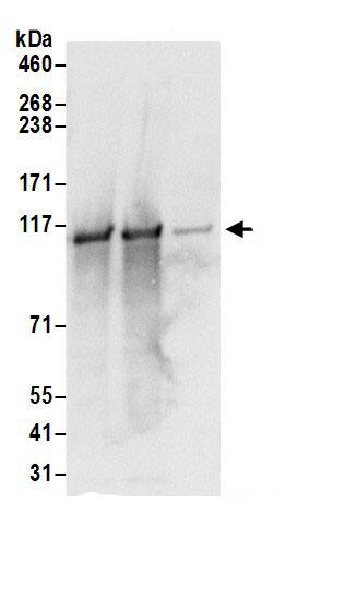 Immunoprecipitation:VDP p115 AntibodyNBP3-30573] -Detection of human p115 by western blot of immunoprecipitates. Samples: Whole cell lysate (0.5 or 1.0 mg per IP reaction; 20% of IP loaded) from 293T cells prepared using NETN lysis buffer. Antibodies: Affinity purified rabbit anti-p115 antibody NBP3-30573 (lot NBP3-30573-1) used for IP at 6 µg per reaction. p115 was also immunoprecipitated by rabbit anti-p115 antibody BL17061. For blotting immunoprecipitated p115, NBP3-30573 was used at 1 µg/ml. Detection: Chemiluminescence with an exposure time of 1 second.