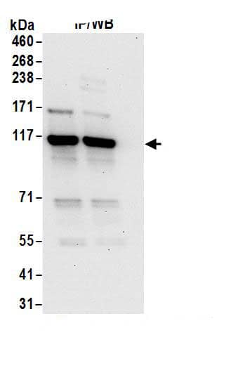 Immunoprecipitation:ADAR AntibodyNBP3-30574] -Detection of human ADAR1 by western blot of immunoprecipitates. Samples: Whole cell lysate (1 mg for IP; 20% of IP loaded) from HEK293T cells. Antibodies: Affinity purified rabbit anti-ADAR1 antibody NBP3-30574 (lot NBP3-30574-1) used for IP at 6 µg/mg lysate. ADAR1 was also immunoprecipitated by rabbit anti-ADAR1.. For blotting immunoprecipitated ADAR1, A300-884A was used at 1 µg/ml. Detection: Chemiluminescence with an exposure time of 30 seconds.