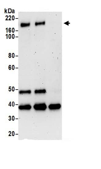 Immunoprecipitation:CELSR1 AntibodyNBP3-30577] -Detection of human CELSR1 by western blot of immunoprecipitates. Samples: Whole cell lysate (1 mg for IP; 20% of IP loaded) prepared using NETN buffer from HeLa cells. Antibodies: Affinity purified rabbit anti-CELSR1 antibody NBP3-30577 (lot NBP3-30577-1) used for IP at 6 µg per reaction. CELSR1 was also immunoprecipitated by rabbit anti-CELSR1.. For blotting immunoprecipitated CELSR1, NBP3-30577 was used at 0.4 µg/ml. Detection: Chemiluminescence with an exposure time of 3 minutes.