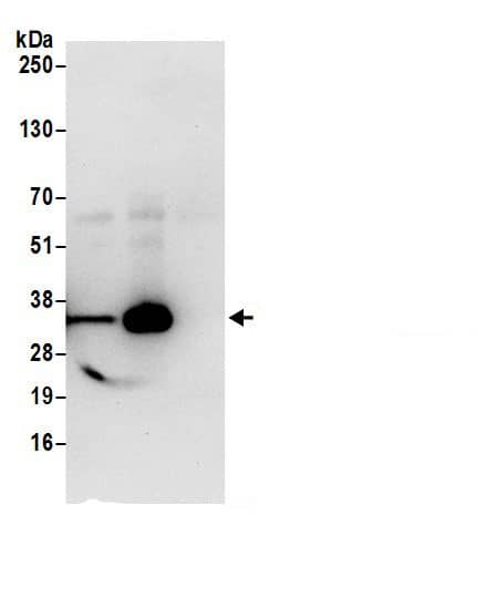 Immunoprecipitation:Lactate Dehydrogenase AntibodyNBP3-30578] -Detection of human Lactate Dehydrogenase B by western blot of immunoprecipitates. Samples: Whole cell lysate (0.5 or 1.0 mg per IP reaction; 20% of IP loaded) from 293T cells prepared using NETN lysis buffer. Antibody: Affinity purified rabbit anti-Lactate Dehydrogenase B antibody NBP3-30578 (lot NBP3-30578-1) used for IP at 6 µg per reaction. Lactate Dehydrogenase B was also immunoprecipitated by rabbit anti-Lactate Dehydrogenase B antibody BL18400. For blotting immunoprecipitated Lactate Dehydrogenase B, NBP3-30578 was used at 0.4 µg/ml. Detection: Chemiluminescence with an exposure time of 10 seconds.