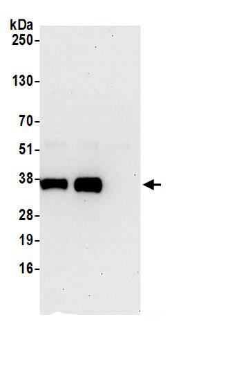 Immunoprecipitation:PPA2 AntibodyNBP3-30579] -Detection of human PPA2 by western blot of immunoprecipitates. Samples: Whole cell lysate (0.5 or 1.0 mg per IP reaction; 20% of IP loaded) from Jurkat cells prepared using NETN lysis buffer. Antibodies: Affinity purified rabbit anti-PPA2 antibody NBP3-30579 (lot NBP3-30579-1) used for IP at 6 µg per reaction. PPA2 was also immunoprecipitated by rabbit anti-PPA2.. For blotting immunoprecipitated PPA2, NBP3-30579 was used at 1 µg/ml. Detection: Chemiluminescence with an exposure time of 30 seconds.