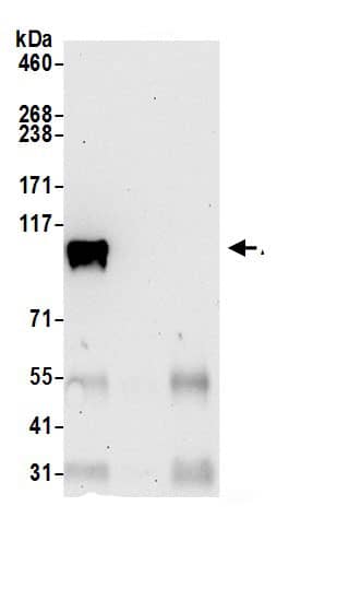 Immunoprecipitation:Aspartate beta hydroxylase AntibodyNBP3-30580] -Detection of human ASPH by western blot of immunoprecipitates. Samples: Whole cell lysate (0.5 or 1.0 mg per IP reaction; 20% of IP loaded) from HeLa cells prepared using NETN lysis buffer. Antibodies: Affinity purified rabbit anti-ASPH antibody NBP3-30580 (lot NBP3-30580-1) used for IP at 6 µg per reaction. ASPH was also immunoprecipitated by rabbit anti-ASPH.. For blotting immunoprecipitated ASPH, A305-343A was used at 0.4 µg/ml. Detection: Chemiluminescence with an exposure time of 30 seconds.