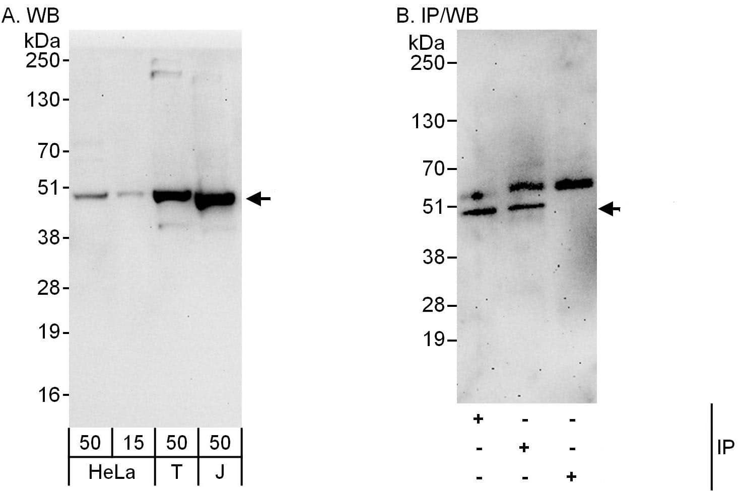 Western Blot:[NBP3-30582]-Detection of human Dysbindin1 by western blot and immunoprecipitation. Samples: Whole cell lysate from HeLa , HEK293T , and Jurkat cells. Antibodies: Affinity purified rabbit anti-Dysbindin1 antibody used for WB at 1 µg/ml and used for IP at 6 µg/mg lysate. Dysbindin1 was also immunoprecipitated by rabbit anti-Dysbindin1 antibody , which recognizes an upstream epitope. Detection: Chemiluminescence with exposure times of 30 seconds and 3 minutes.