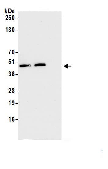 Immunoprecipitation:FAM105B/OTULIN AntibodyNBP3-30584] -Detection of human OTULIN by western blot of immunoprecipitates. Samples: Whole cell lysate (1.0 mg per IP reaction; 20% of IP loaded) from HeLa cells prepared using NETN lysis buffer. Antibodies: Affinity purified rabbit anti-OTULIN antibody (NBP3-30584 lot 1) used for IP at 6 µg per reaction. OTULIN was also immunoprecipitated by rabbit anti-OTULIN.. For blotting immunoprecipitated OTULIN,  was used at 0.4 mg/ml. Detection: Chemiluminescence with an exposure time of 10 seconds.