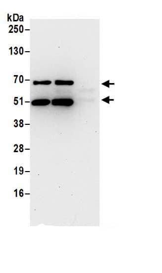Immunoprecipitation:ARL6IP4 AntibodyNBP3-30585] -Detection of human ARL6IP4 by western blot of immunoprecipitates. Samples: Whole cell lysate (0.5 or 1.0 mg per IP reaction; 20% of IP loaded) from 293T cells prepared using NETN lysis buffer. Antibodies: Affinity purified rabbit anti-ARL6IP4 antibody NBP3-30585 (lot NBP3-30585-1) used for IP at 6 µg per reaction. ARL6IP4 was also immunoprecipitated by rabbit anti-ARL6IP4.. For blotting immunoprecipitated ARL6IP4, NBP3-30585 was used at 0.4 µg/ml. Detection: Chemiluminescence with an exposure time of 30 seconds.