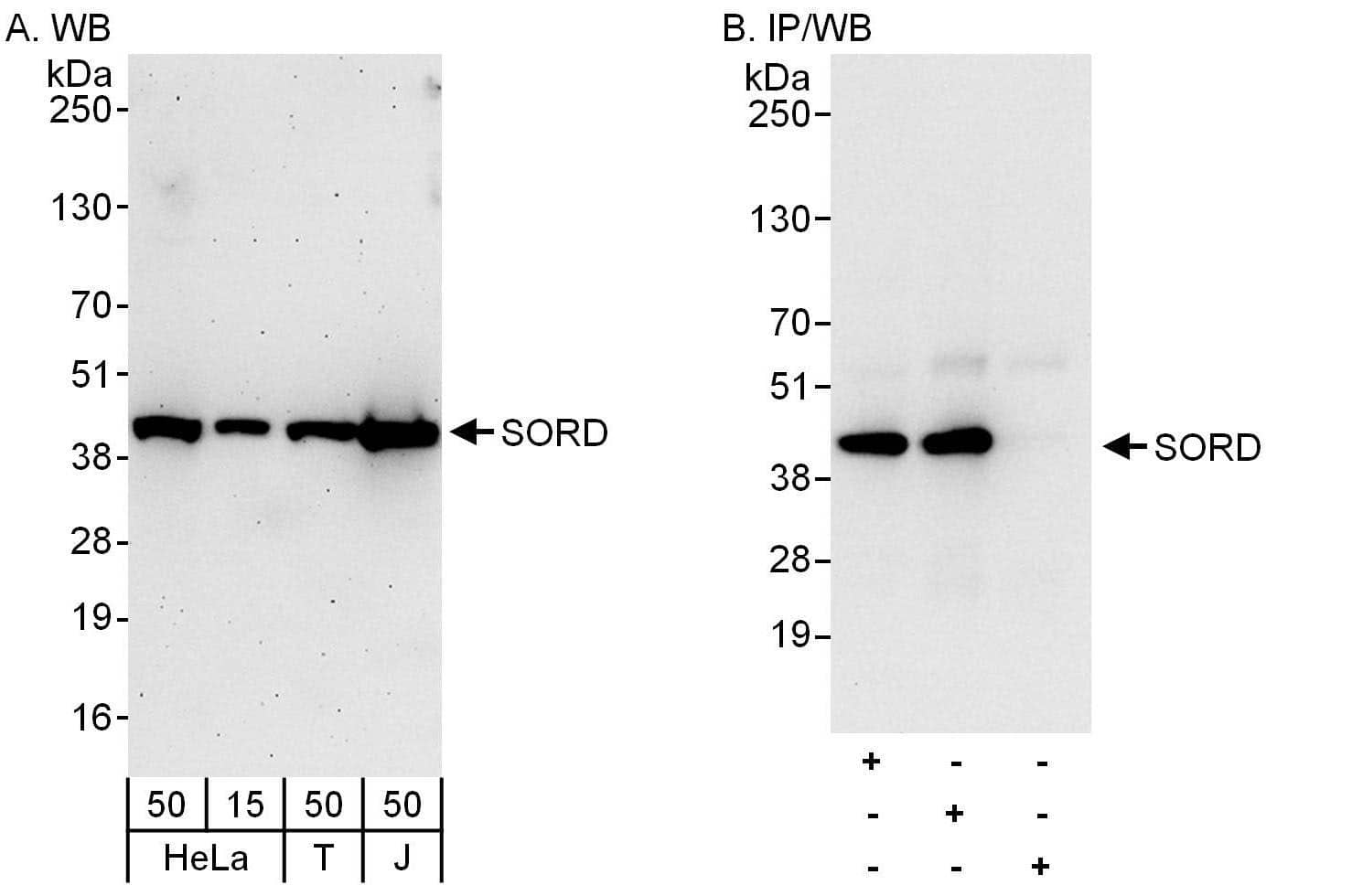 Western Blot:[NBP3-30587]-Detection of human SORD by western blot and immunoprecipitation. Samples: Whole cell lysate from HeLa , HEK293T , and Jurkat cells. Antibodies: Affinity purified rabbit anti-SORD antibody used for WB at 0. 04 µg/ml and 0. 4 µg/ml and used for IP at 6 µg/mg lysate. SORD was also immunoprecipitated by rabbit anti-SORD antibody , which recognizes an upstream epitope. Detection: Chemiluminescence with exposure times of 3 minutes and 10 seconds.