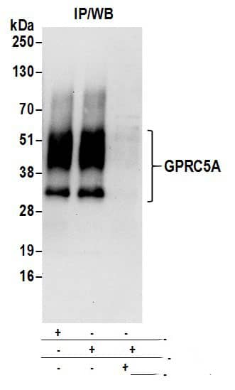 Immunoprecipitation:[NBP3-30588]-Detection of human GPRC5A by western blot of immunoprecipitates. Samples: Whole cell lysate prepared using NETN buffer from HeLa cells. Antibodies: Affinity purified rabbit antibody used for IP at 6 µg per reaction. GPRC5A was also immunoprecipitated by rabbit antibody. For blotting immunoprecipitated GPRC5A, was used at 0. 4 µg/ml. Detection: Chemiluminescence with an exposure time of 30 seconds.
