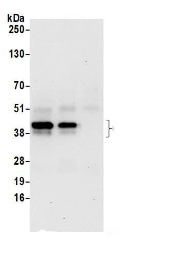 Immunoprecipitation:SNURPORTIN1 AntibodyNBP3-30590] -Detection of human SNUPN by western blot of immunoprecipitates. Samples: Whole cell lysate (0.5 or 1.0 mg per IP reaction; 20% of IP loaded) from 293T cells prepared using NETN lysis buffer. Antibodies: Affinity purified rabbit anti-SNUPN antibody NBP3-30590 (lot NBP3-30590-1) used for IP at 6 µg per reaction. SNUPN was also immunoprecipitated by rabbit anti-SNUPN.. For blotting immunoprecipitated SNUPN, NBP3-30590 was used at 0.4 µg/ml. Detection: Chemiluminescence with an exposure time of 30 seconds.