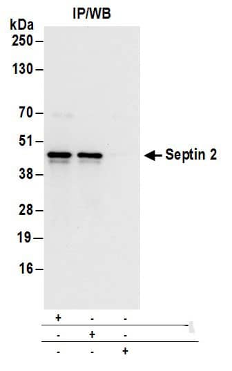 Immunoprecipitation:[NBP3-30591]-Detection of human Septin 2 by western blot of immunoprecipitates. Samples: Whole cell lysate from 293T cells. Antibodies: Affinity purified rabbit anti-Septin 2 antibody used for IP at 6 µg/mg lysate. Septin 2 was also immunoprecipitated by rabbit anti-Septin 2 antibody. For blotting immunoprecipitated Septin 2, was used at 1 µg/ml. Detection: Chemiluminescence with an exposure time of 3 seconds.