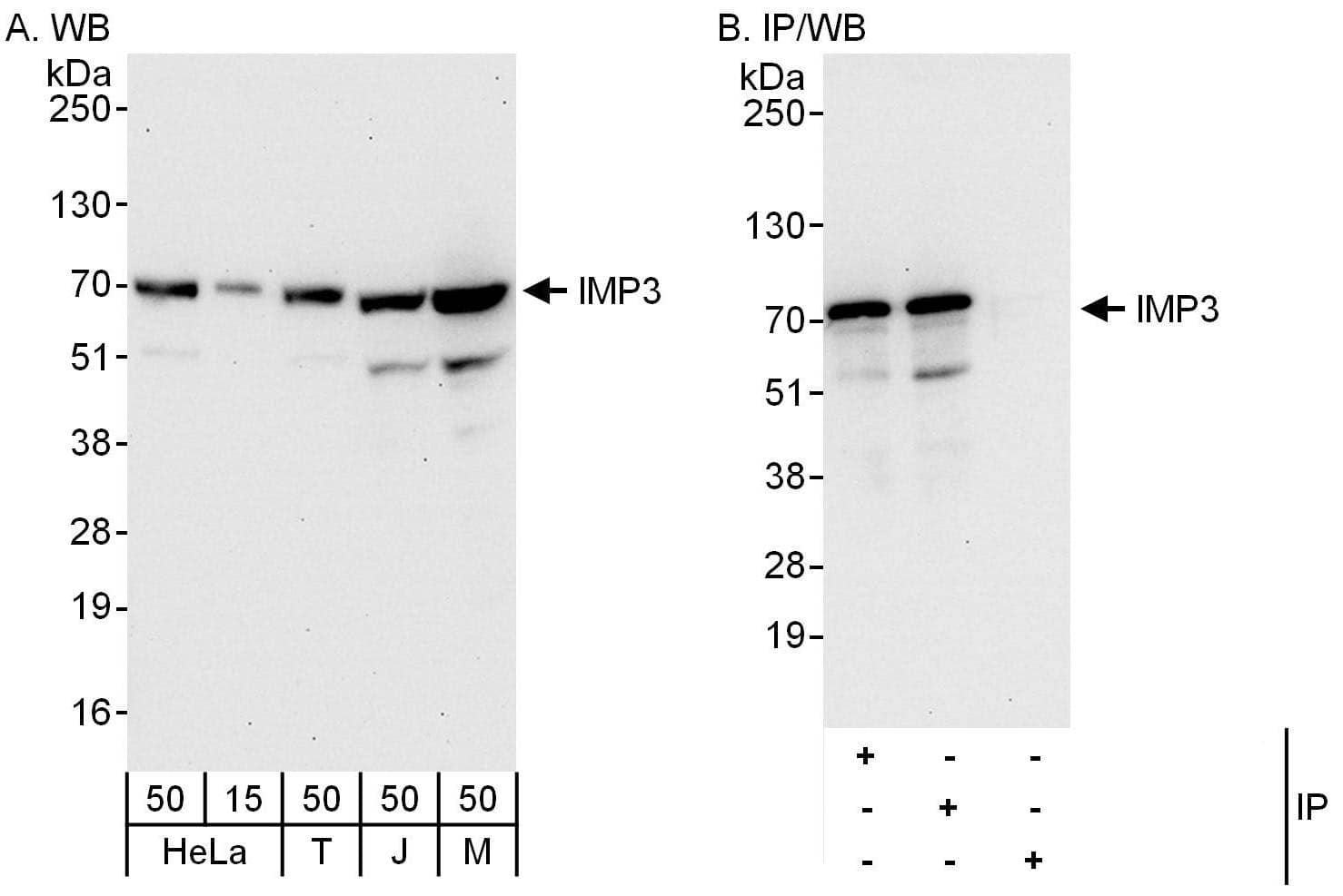 Western Blot:[NBP3-30593]-Detection of human and mouse IMP3 by western blot and immunoprecipitation. Samples: Whole cell lysate from HeLa , HEK293T , Jurkat and mouse NIH 3T3 cells. Antibodies: Affinity purified rabbit anti-IMP3 antibody used for WB at 0. 04 µg/ml and 1 µg/ml and used for IP at 6 µg/mg lysate. IMP3 was also immunoprecipitated by rabbit anti-IMP3 antibody , which recognizes an upstream epitope. Detection: Chemiluminescence with exposure times of 30 seconds and 10 seconds.