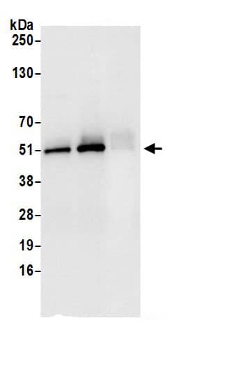 Immunoprecipitation:Fumarase AntibodyNBP3-30597] -Detection of human FH by western blot of immunoprecipitates. Samples: Whole cell lysate (0.5 or 1.0 mg per IP reaction; 20% of IP loaded) from HeLa cells prepared using NETN lysis buffer. Antibodies: Affinity purified rabbit anti-FH antibody NBP3-30597 (lot NBP3-30597-1) used for IP at 6 µg per reaction. FH was also immunoprecipitated by rabbit anti-FH antibody BL20726. For blotting immunoprecipitated FH, NBP3-30597 was used at 0.1 µg/ml. Detection: Chemiluminescence with an exposure time of 3 seconds.