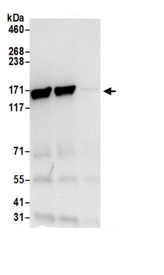 Immunoprecipitation:Isoleucyl tRNA synthetase AntibodyNBP3-30608] -Detection of human IARS by western blot of immunoprecipitates. Samples: Whole cell lysate (0.5 or 1.0 mg per IP reaction; 20% of IP loaded) from 293T cells prepared using NETN lysis buffer. Antibodies: Affinity purified rabbit anti-IARS antibody NBP3-30608 (lot NBP3-30608-1) used for IP at 6 µg per reaction. IARS was also immunoprecipitated by rabbit anti-IARS antibody BL18491. For blotting immunoprecipitated IARS, NBP3-30608 was used at 0.4 µg/ml. Detection: Chemiluminescence with an exposure time of 10 seconds.