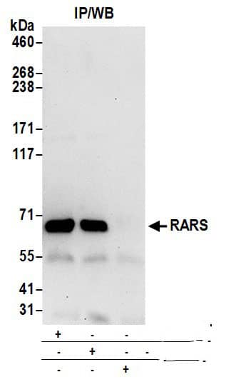 Immunoprecipitation:[NBP3-30609]-Detection of human RARS by western blot of immunoprecipitates. Samples: Whole cell lysate from 293T cells prepared using NETN lysis buffer. Antibodies: Affinity purified rabbit anti-RARS antibody used for IP at 6 µg per reaction. RARS was also immunoprecipitated by rabbit anti-RARS antibody. For blotting immunoprecipitated RARS, was used at 0. 4 µg/ml. Detection: Chemiluminescence with an exposure time of 30 seconds.