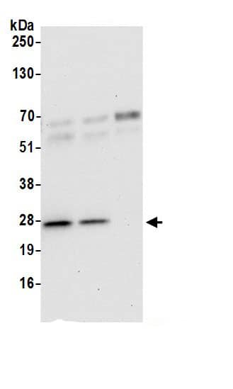 Immunoprecipitation:BAG2 AntibodyNBP3-30610] -Detection of human BAG2 by western blot of immunoprecipitates. Samples: Whole cell lysate (0.5 or 1.0 mg per IP reaction; 20% of IP loaded) from 293T cells prepared using NETN lysis buffer. Antibodies: Affinity purified rabbit anti-BAG2 antibody NBP3-30610 (lot NBP3-30610-1) used for IP at 6 µg per reaction. BAG2 was also immunoprecipitated by rabbit anti-BAG2 antibody BL18503. For blotting immunoprecipitated BAG2, NBP3-30610 was used at 1 µg/ml. Detection: Chemiluminescence with an exposure time of 30 seconds.