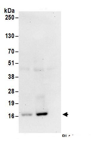 Immunoprecipitation:RPS19 AntibodyNBP3-30612] -Detection of human RPS19 by western blot of immunoprecipitates. Samples: Whole cell lysate (1 mg for IP; 20% of IP loaded) from HeLa cells. Antibodies: Affinity purified rabbit anti-RPS19 antibody NBP3-30612 (lot NBP3-30612-1) used for IP at 6 µg/mg lysate. RPS19 was inefficiently immunoprecipitated by rabbit anti-RPS19 antibody BL14433. For blotting immunoprecipitated RPS19, NBP3-30612 was used at 1 µg/ml. Detection: Chemiluminescence with an exposure time of 30 seconds.