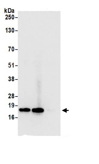 Immunoprecipitation:RPS15 AntibodyNBP3-30613] -Detection of human RPS15 by western blot of immunoprecipitates. Samples: Whole cell lysate (0.5 or 1.0 mg per IP reaction; 20% of IP loaded) from 293T cells prepared using NETN lysis buffer. Antibodies: Affinity purified rabbit anti-RPS15 antibody NBP3-30613 (lot NBP3-30613-1) used for IP at 6 µg per reaction. RPS15 was also immunoprecipitated by rabbit anti-RPS15.. For blotting immunoprecipitated RPS15, NBP3-30613 was used at 0.4 µg/ml. Detection: Chemiluminescence with an exposure time of 3 seconds.