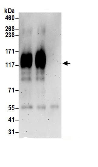 Immunoprecipitation:KCC4/SLC12A7 AntibodyNBP3-30614] -Detection of human KCC4 by western blot of immunoprecipitates. Samples: Whole cell lysate (1 mg for IP; 20% of IP loaded) prepared using NETN buffer from Jurkat cells. Antibodies: Affinity purified rabbit anti-KCC4 antibody NBP3-30614 (lot NBP3-30614-1) used for IP at 6 µg per reaction. KCC4 was also immunoprecipitated by rabbit anti-KCC4.. For blotting immunoprecipitated KCC4, NBP3-30614 was used at 0.4 µg/ml. Detection: Chemiluminescence with an exposure time of 3 minutes.