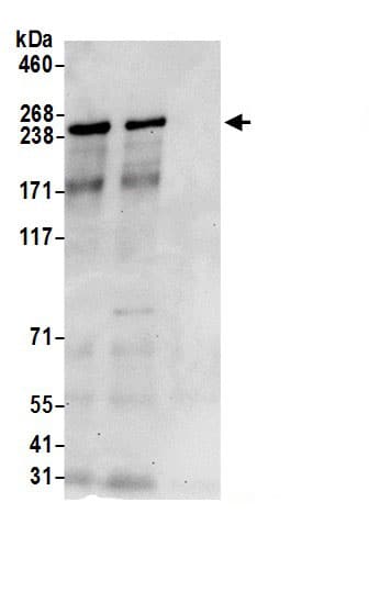 Immunoprecipitation:Tight Junction Protein 1 AntibodyNBP3-30618] -Detection of human TJP1/ZO-1 by western blot of immunoprecipitates. Samples: Whole cell lysate (0.5 or 1.0 mg per IP reaction; 20% of IP loaded) from 293T cells prepared using NETN lysis buffer. Antibody: Affinity purified rabbit anti-TJP1/ZO-1 antibody NBP3-30618 (lot NBP3-30618-1) used for IP at 6 µg per reaction. TJP1/ZO-1 was also immunoprecipitated by rabbit anti-TJP1/ZO-1 antibody BL18749. For blotting immunoprecipitated TJP1/ZO-1, NBP3-30618 was used at 0.4 µg/ml. Detection: Chemiluminescence with an exposure time of 30 seconds.