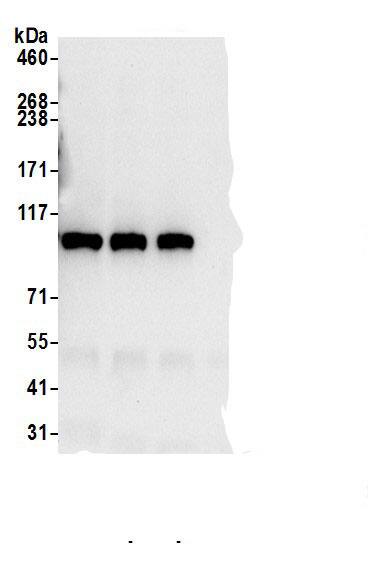 Immunoprecipitation:MTHFD1 AntibodyNBP3-30621] -Detection of human MTHFD1 by western blot of immunoprecipitates. Samples: Whole cell lysate (0.5 or 1.0 mg per IP reaction; 20% of IP loaded) from 293T cells prepared using NETN lysis buffer. Antibodies: Affinity purified rabbit anti-MTHFD1 antibody NBP3-30621 (lot NBP3-30621-1) used for IP at 6 µg per reaction. MTHFD1 was also immunoprecipitated by rabbit anti-MTHFD1 antibodies. For blotting immunoprecipitated MTHFD1, NBP3-30621 was used at 1 µg/ml. Detection: Chemiluminescence with an exposure time of 10 seconds.