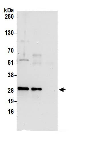 Immunoprecipitation:CLIC4 AntibodyNBP3-30622] -Detection of human CLIC4 by western blot of immunoprecipitates. Samples: Whole cell lysate (0.5 or 1.0 mg per IP reaction; 20% of IP loaded) from 293T cells prepared using NETN lysis buffer. Antibodies: Affinity purified rabbit anti-CLIC4 antibody NBP3-30622 (lot NBP3-30622-1) used for IP at 6 µg per reaction. CLIC4 was also immunoprecipitated by rabbit anti-CLIC4.. For blotting immunoprecipitated CLIC4, NBP3-30622 was used at 1 µg/ml. Detection: Chemiluminescence with an exposure time of 10 seconds.