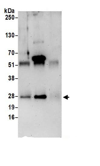 Immunoprecipitation:Translin AntibodyNBP3-30623] -Detection of human TSN by western blot of immunoprecipitates. Samples: Whole cell lysate (0.5 or 1.0 mg per IP reaction; 20% of IP loaded) from 293T cells prepared using NETN lysis buffer. Antibodies: Affinity purified rabbit anti-TSN antibody NBP3-30623 (lot NBP3-30623-1) used for IP at 6 µg per reaction. TSN was also immunoprecipitated by rabbit anti-TSN antibody BL21277. For blotting immunoprecipitated TSN, NBP3-30623 was used at 1 µg/ml. Detection: Chemiluminescence with an exposure time of 75 seconds.